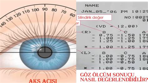 göz tansiyonu ölçüm değerleri